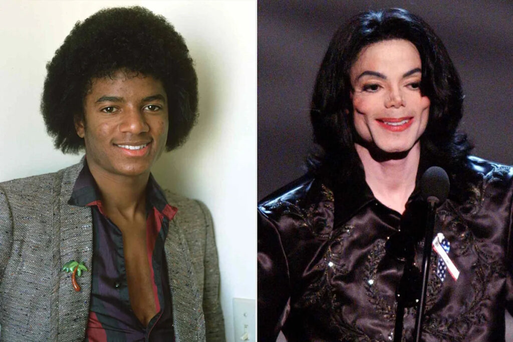 Did Michael Jackson Get Plastic Surgery: The Full Story